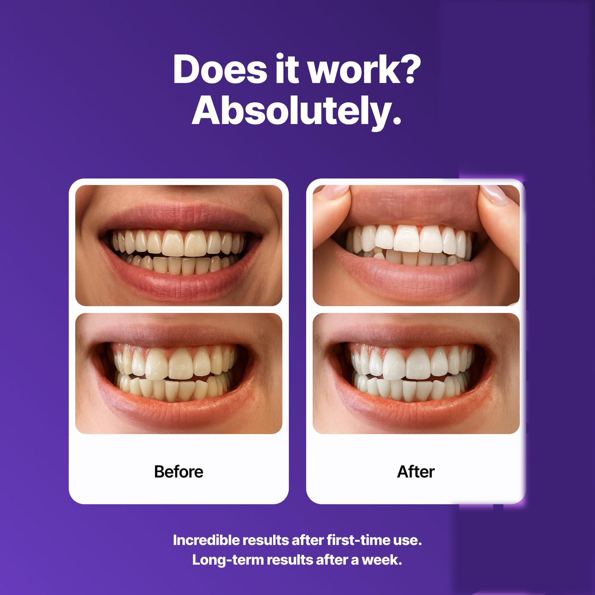 Dr Dent Purple Teeth Whitening Tooth Strips Care Tooth Enamel Layer
