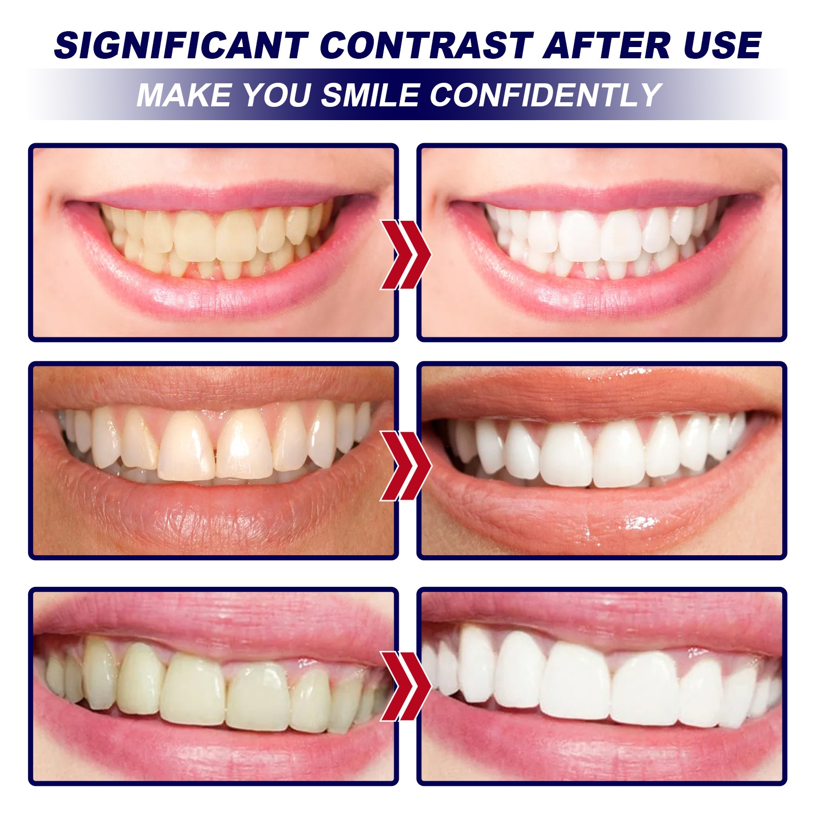 Eelhoe Teeth Whitening Strips Clear Stains Fresh Breath Gentle Care