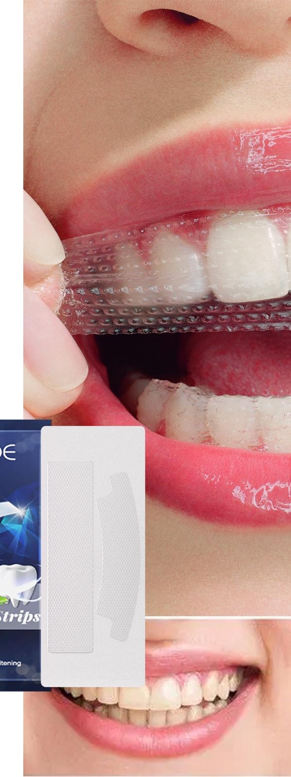 Eelhoe Whitening Strips for a Brighter Smile & Fresh Breath
